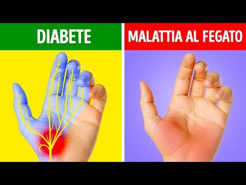 Mani secche stress